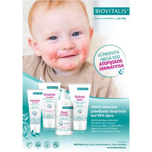 Start paket kod atopijskog dermatitisa