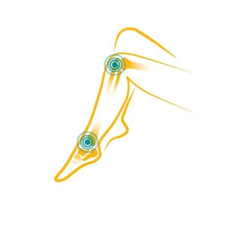 Kurkumin gel