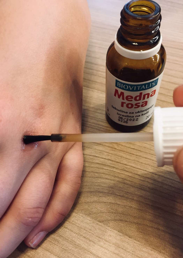 Medna Rosa